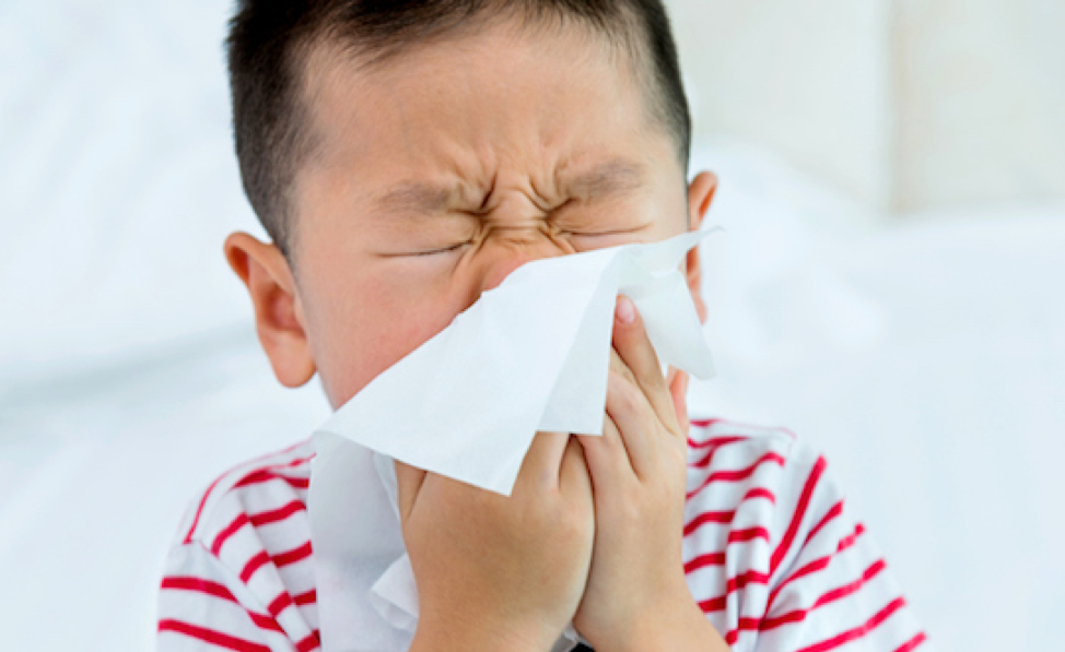 Allergies | Texas Children's Hospital 