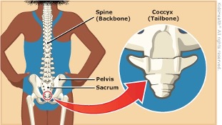 How to get Relief from Tailbone Pain