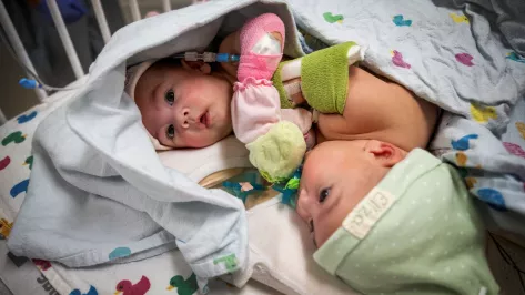 Texas Children’s Hospital Announces Homecoming for Formerly Conjoined Twin Girls Ella Grace and Eliza Faith Fuller