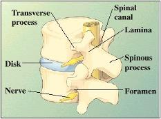 Vertebrae-Disk