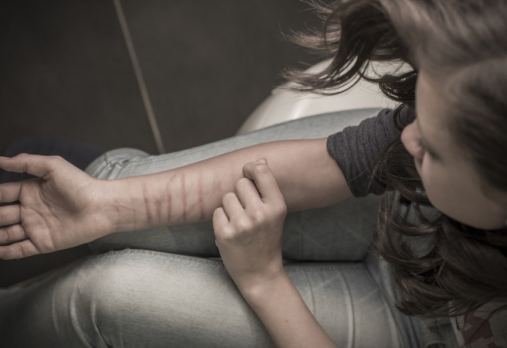 Self Harm