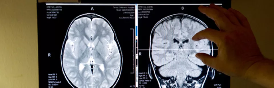 <p>Neurosurgery</p>